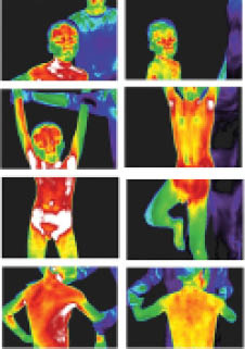 自閉症孩子紅外線掃描圖。顏色代表溫度：白色最熱，紅色次熱，然後是黃、綠、藍，黑色最冷，而綠色是健康顏色。左圖有熱，喝了固態水一刻鐘後，右圖症狀改善。