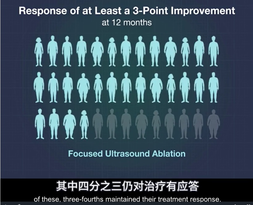 2023 02 26 帕金森治疗 5