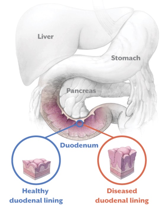 2023 07 10 Clinic Study