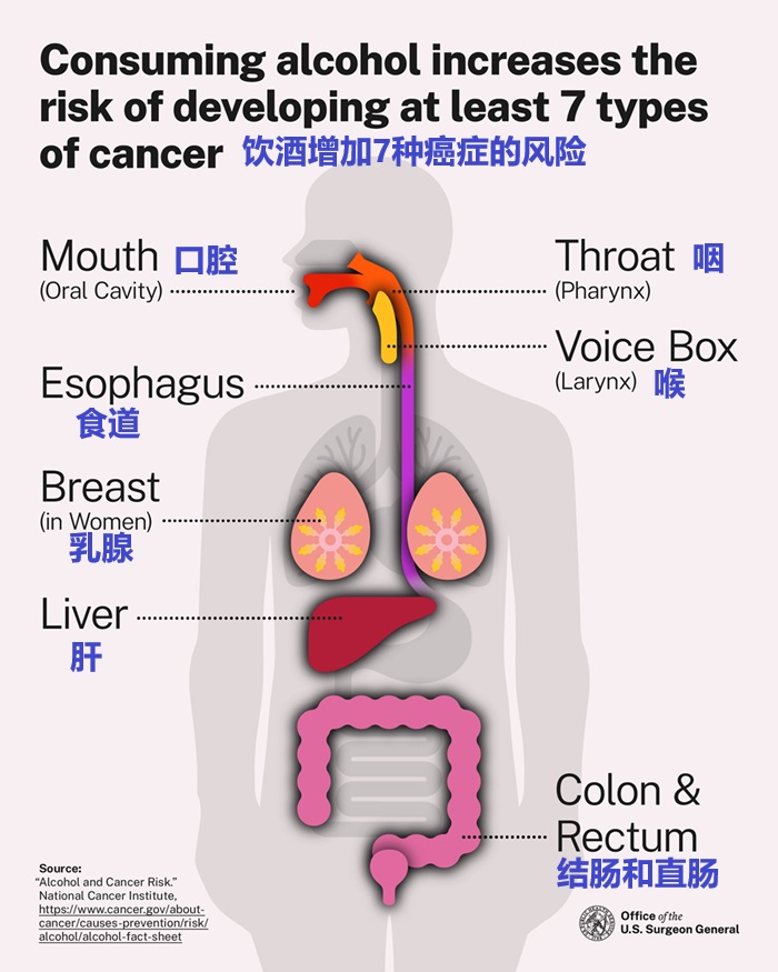 2025 01 07 oash alcohol cancer fig3
