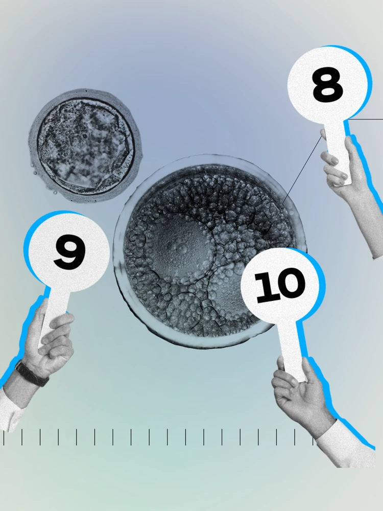 2026 01 18 tech 5 Embryo scoring